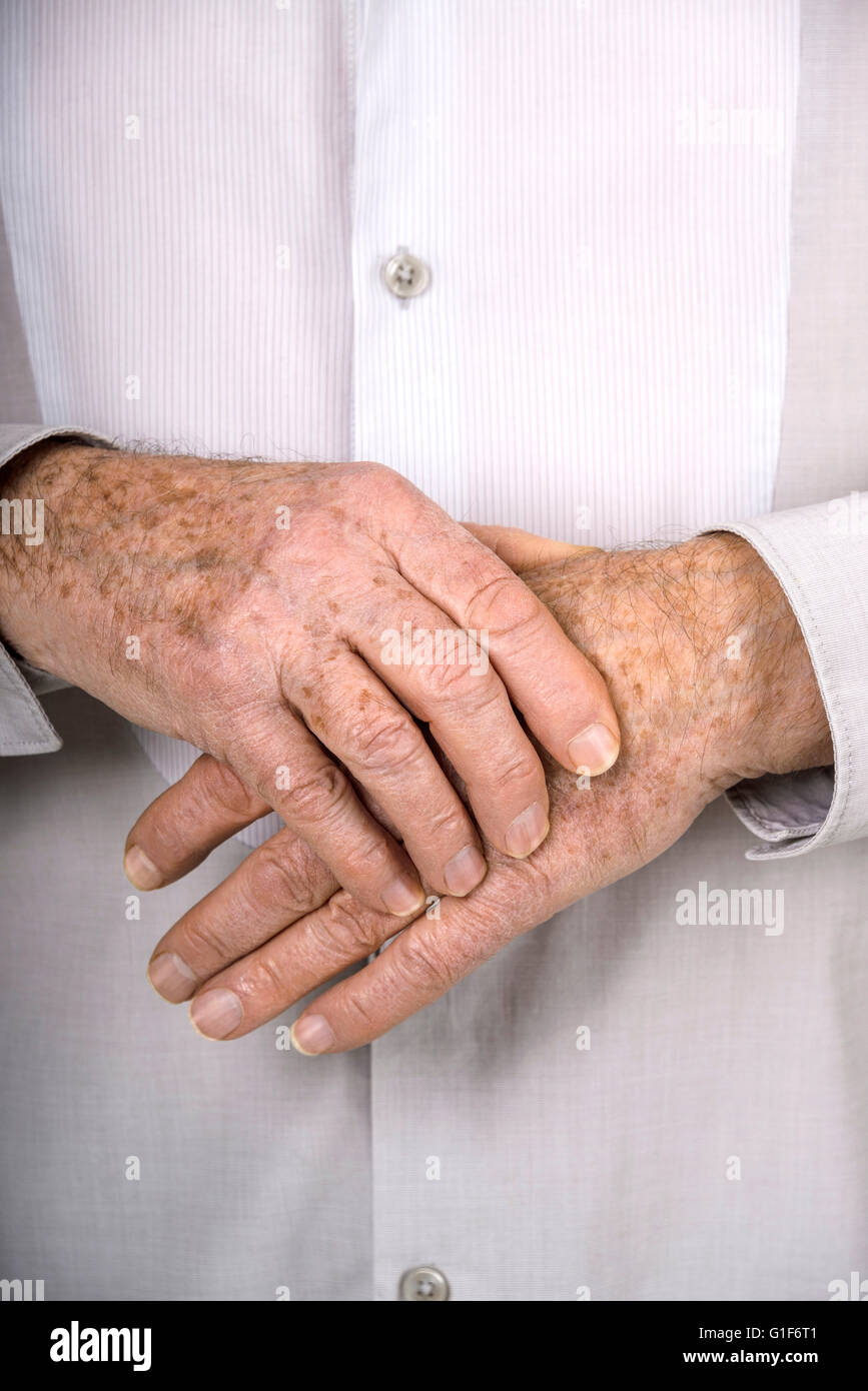 Parution du modèle. Senior man holding sa main. Banque D'Images