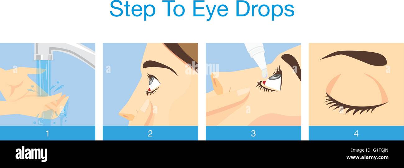 L'étape de traitement des yeux avec des gouttes Illustration de Vecteur