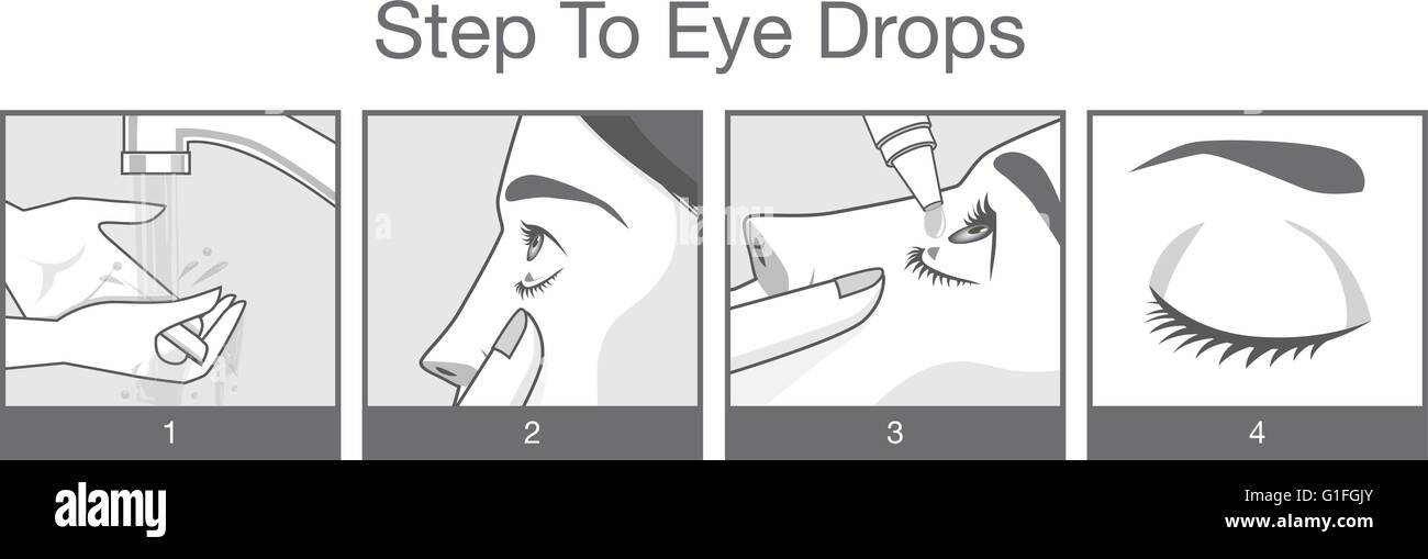 L'étape de traitement des yeux avec des gouttes Illustration de Vecteur