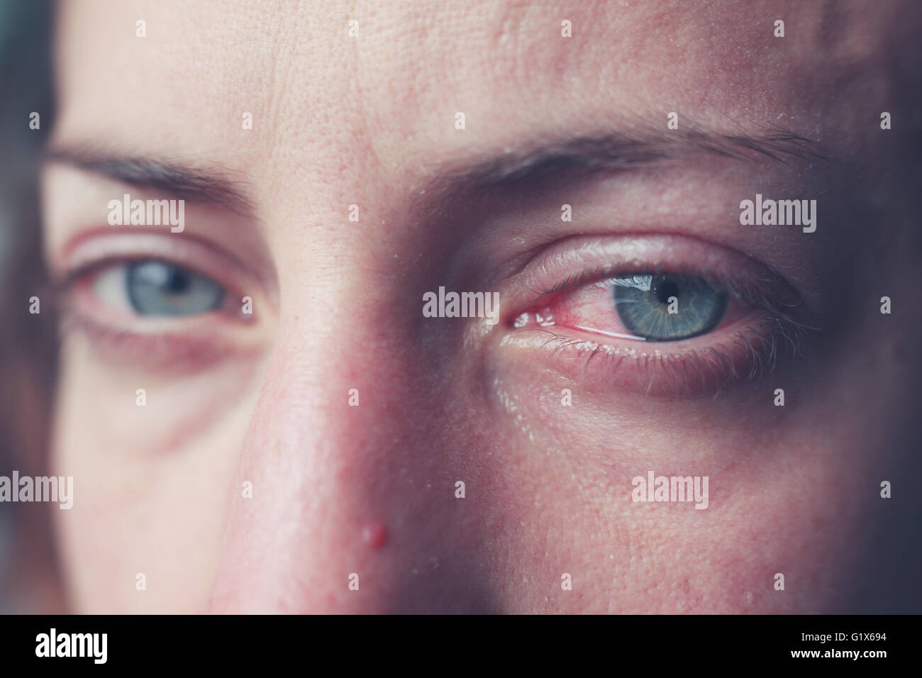 Yeux qui pleurent Banque de photographies et d’images à haute résolution Alamy