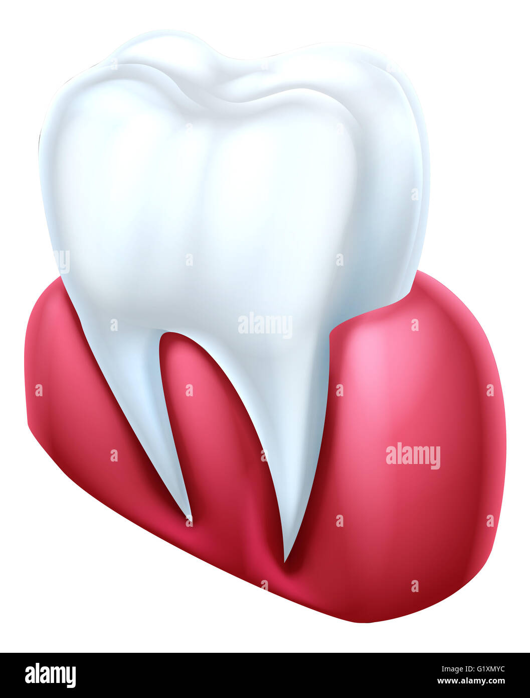 Une illustration médicale en coupe dentaire d'une dent et la gencive Banque D'Images