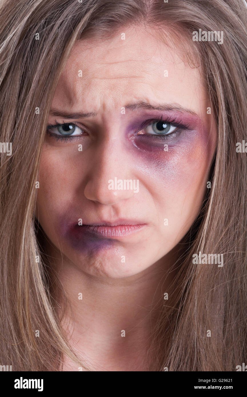 Visage Triste Presque Pleurer D Un Blesse Battu Et Meurtri Femme Victime De Violence Domestique Photo Stock Alamy Visage Triste Presque Pleurer D Un Blesse Battu Et Meurtri Femme Victime De Violence Domestique Photo Stock Alamy