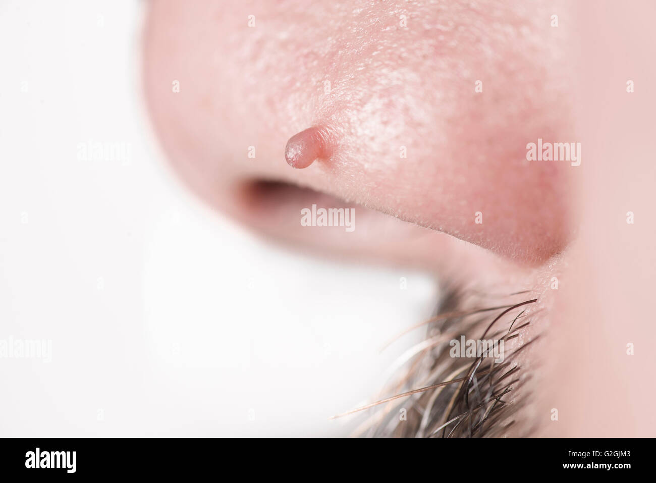 Taupe blanc sur un mans nez. Banque D'Images