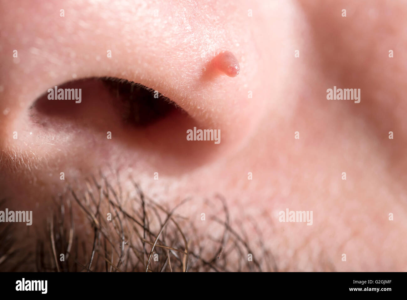 Taupe blanc sur un mans nez. Banque D'Images