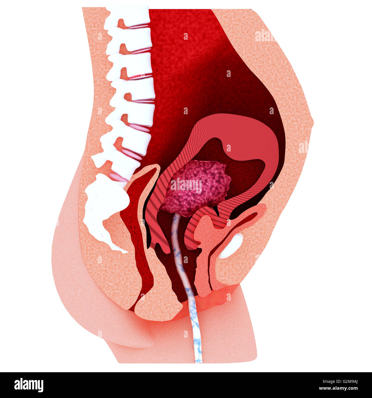 Coupe d'utérus avec cordon ombilical Banque D'Images