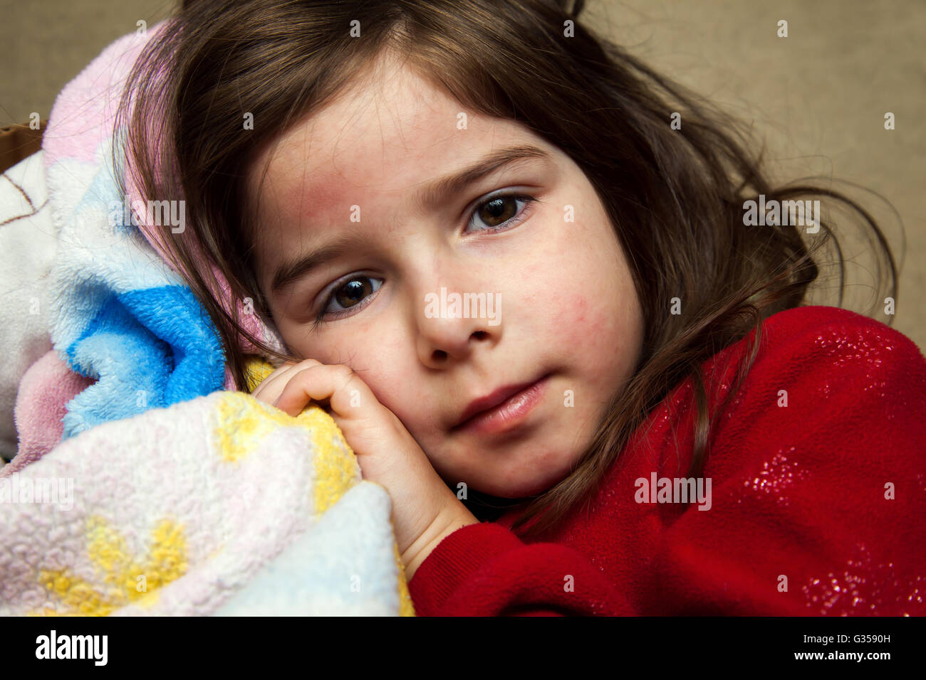 Une jeune fille avec une éruption de fièvre de câlins avec une couverture et regarde la caméra avec une expression vide. Banque D'Images