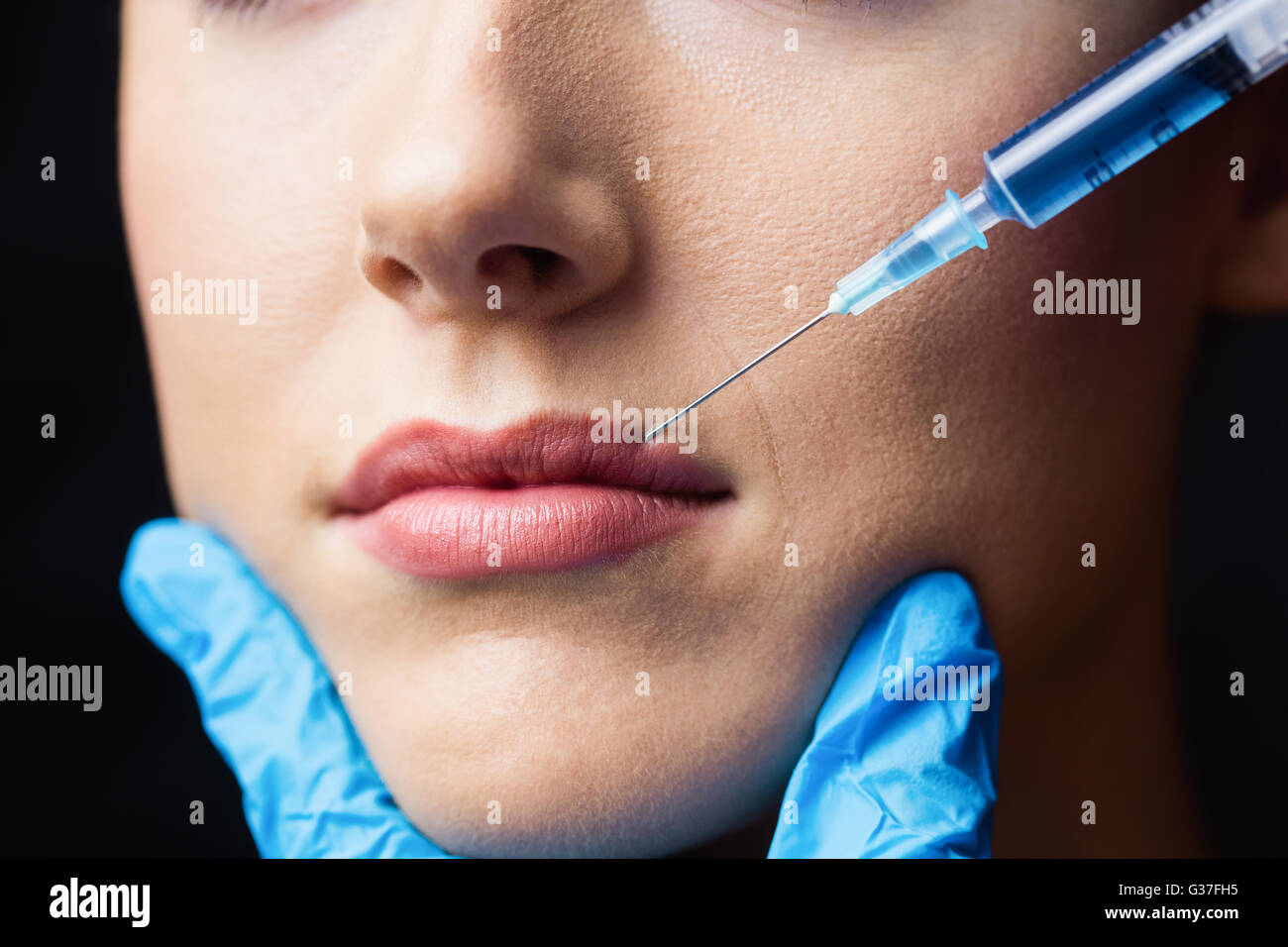 Woman receiving botox injection sur ses lèvres Banque D'Images