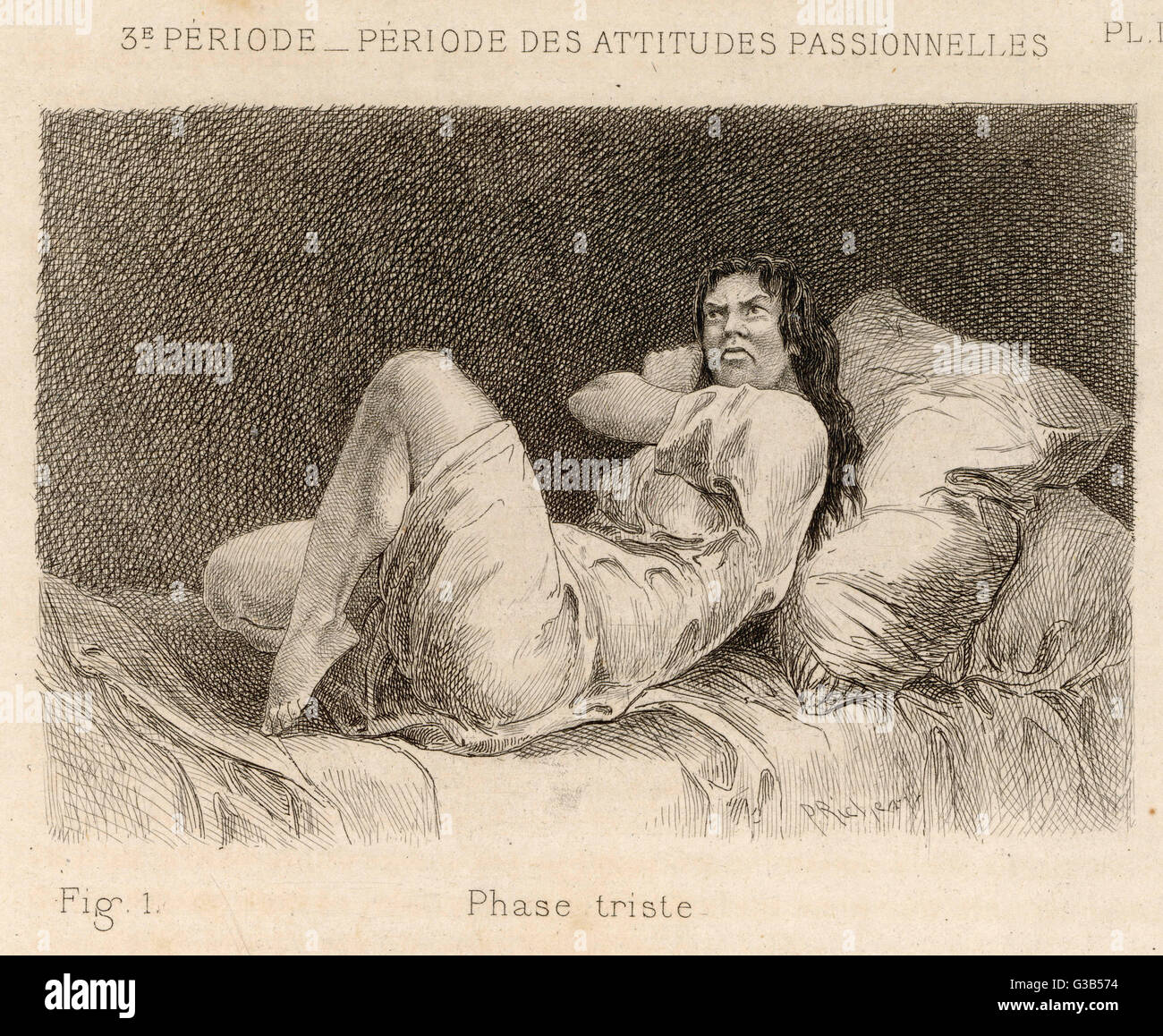 Malade mentale à la Salpetriere affichant le 'melancholy phase' Date : 1881 Banque D'Images