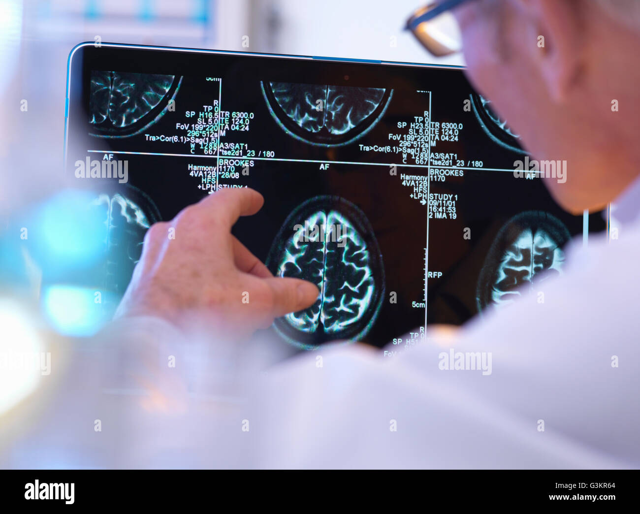 Évaluation de radiologue CT scan cérébral Banque D'Images