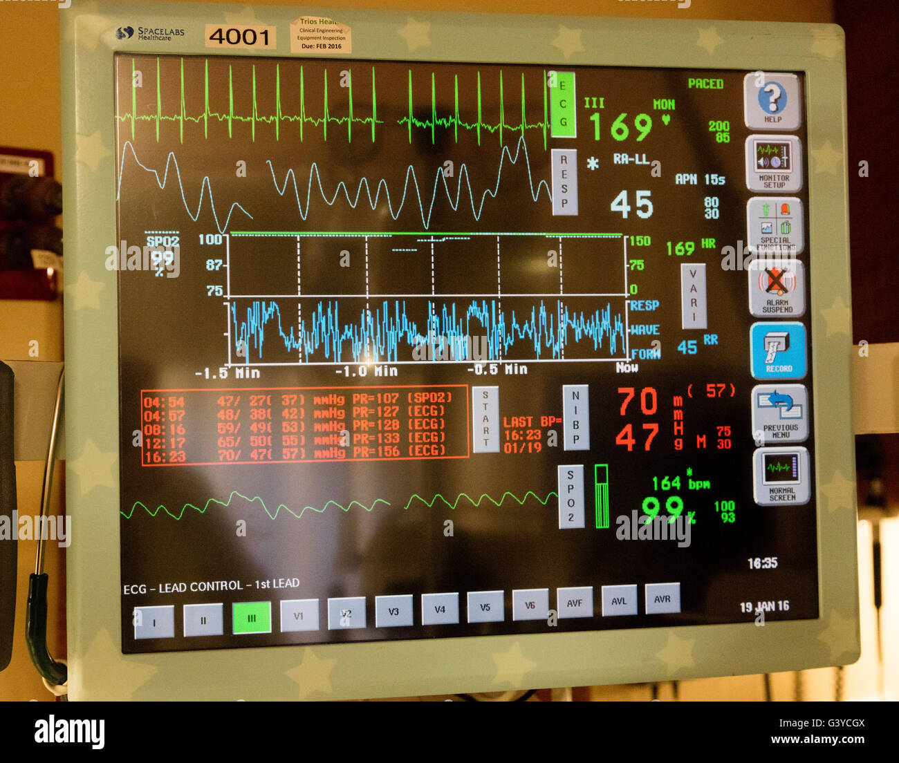 Moniteur pour bébé prématuré, USIN natal d'unité de soins intensifs, l'Hôpital général de Kennewick trios, USA Banque D'Images