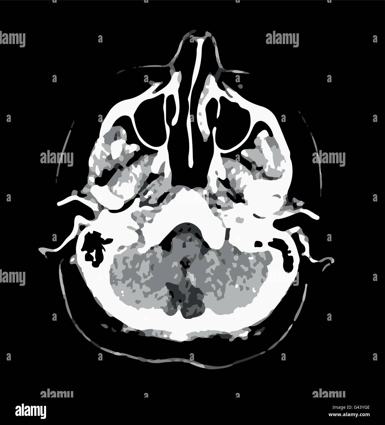 CT scan de cerveau. Le noir et blanc graphique de scénario. Les soins de santé. Diagnostic de problèmes de santé. Tête humaine. Illustration de Vecteur