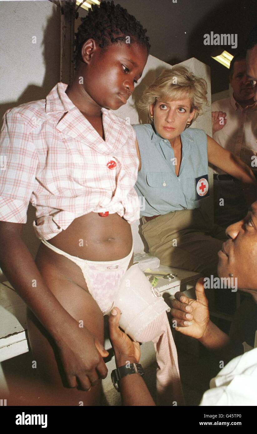 Diana, princesse de Galles regarde comme un docteur mesure Sandra Tigica 13, pour une fausse jambe à l'atelier orthopédique à Neves Bendinha, à la périphérie de la capitale angolaise Luanda ce matin.Voir PA Story ROYAL Diana.PHOTO DE PISCINE PAR JOHN STILLWELL/PA. Banque D'Images