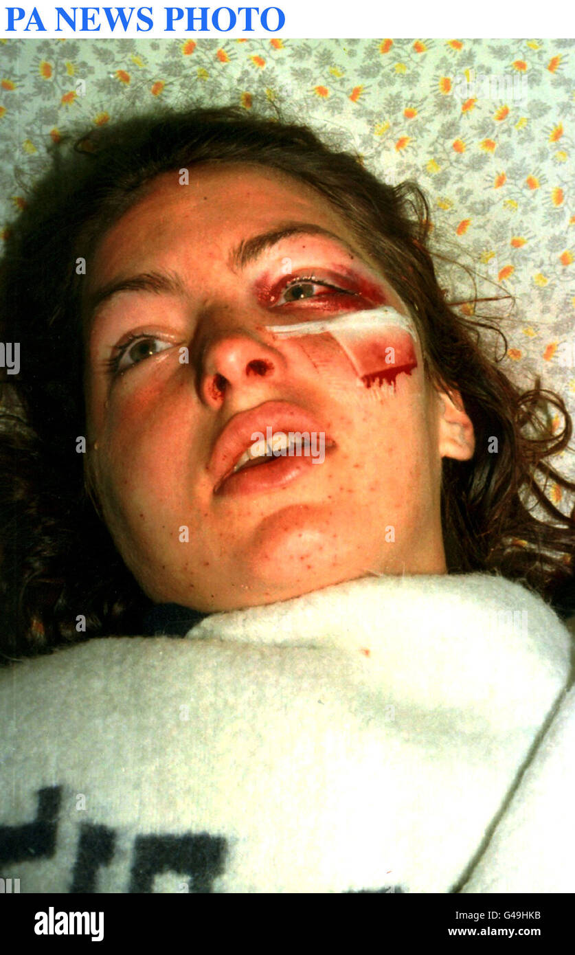 PA NEWS PHOTO 13/8/97 BRITISH TOURIST CHARLOTTE GEBBE COMME ELLE SE RÉVEILLE APRÈS LE COURS D'UNE OPÉRATION À L'hôpital Soroka de Beer Sheva. CHARLOTTE (20 ANS) ET SON AMI JEFFREY HUNTER 22 BRITANNIQUES ONT ÉTÉ ÉGALEMENT TOURNÉ TÔT CE MATIN PAR UN HOMME QUI LES ALORS QUE L'auto-stop près d'EILAT HYNTER A été tué. La POLICE A DÉCLARÉ QU'ILS ÉTAIENT ENCORE LA CHASSE POUR LE TIREUR ET NE POUVAIT PAS ENCORE DIRE SI LE TOURNAGE ÉTAIT CRIMINELLE OU POLITIQUES. Banque D'Images