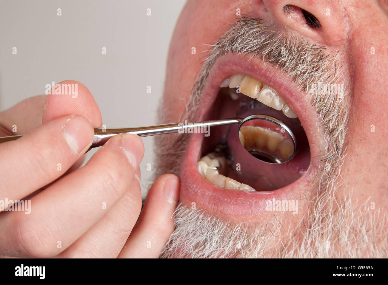 Patient, 59 ans, lors d'un check-up chez le dentiste Banque D'Images