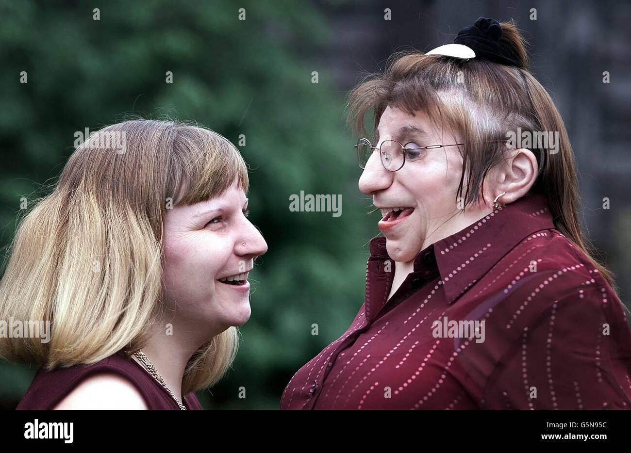 Janet Craven (R) avec sa nièce Andrea Dalton, à Lupset, Wakefield, West Yorkshire, après son opération révolutionnaire qui attachait des oreilles en silicone à sa tête vendredi dernier. *Janet, 47 ans, qui souffre du syndrome de Treacher Collins, un trouble génétique rare, a déclaré que ses nouvelles oreilles en silicone lui ont fait se sentir plus femme-comme et moins conscient de lui-même au sujet de son apparence. Mme Craven, divorcée, a déclaré qu'elle a éclaté en larmes et a embrassé tous les médecins et infirmières de l'hôpital après avoir attaché les oreilles. Banque D'Images