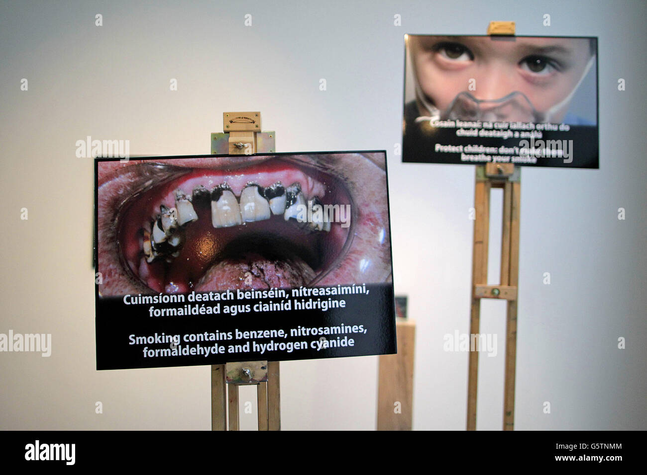 Photographies qui apparaîtront sur les emballages de cigarettes vendus en Irlande à la RHA Gallery, Dublin. Banque D'Images