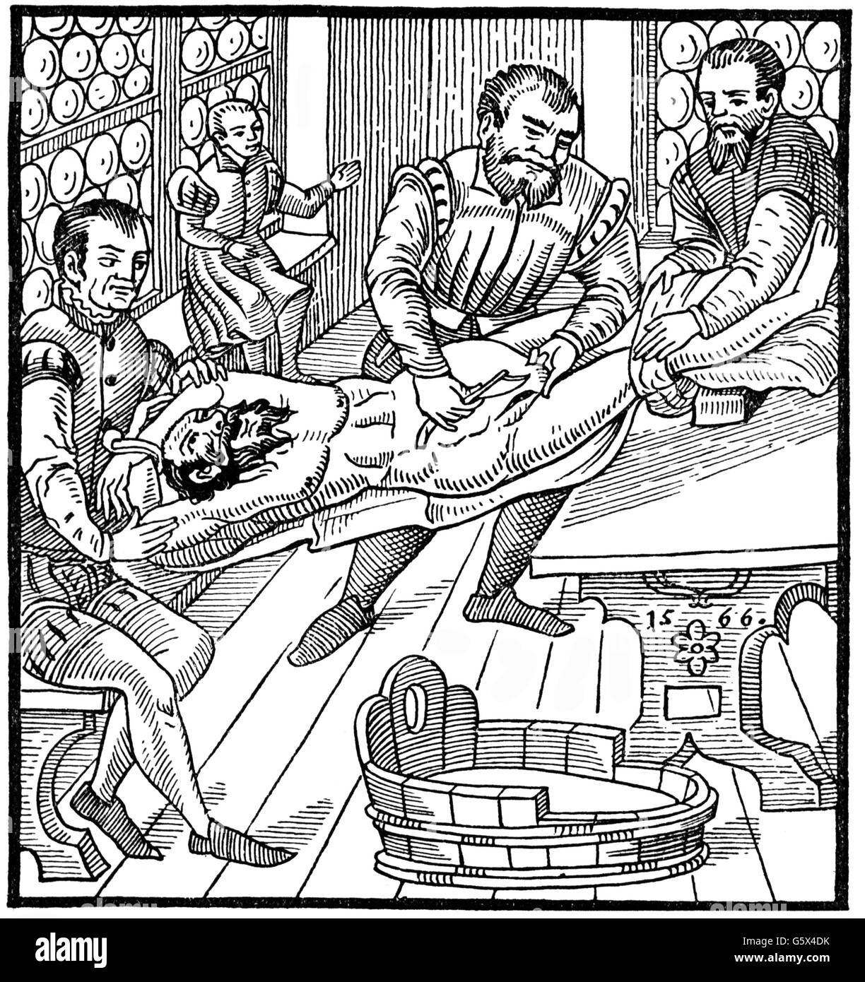 Médecine, chirurgie, hernie, coupe de bois, hors de: Caspar Stromayr (+ 1566 / 1567), 'Practica copiosa', 1566, droits additionnels-Clearences-non disponible Banque D'Images