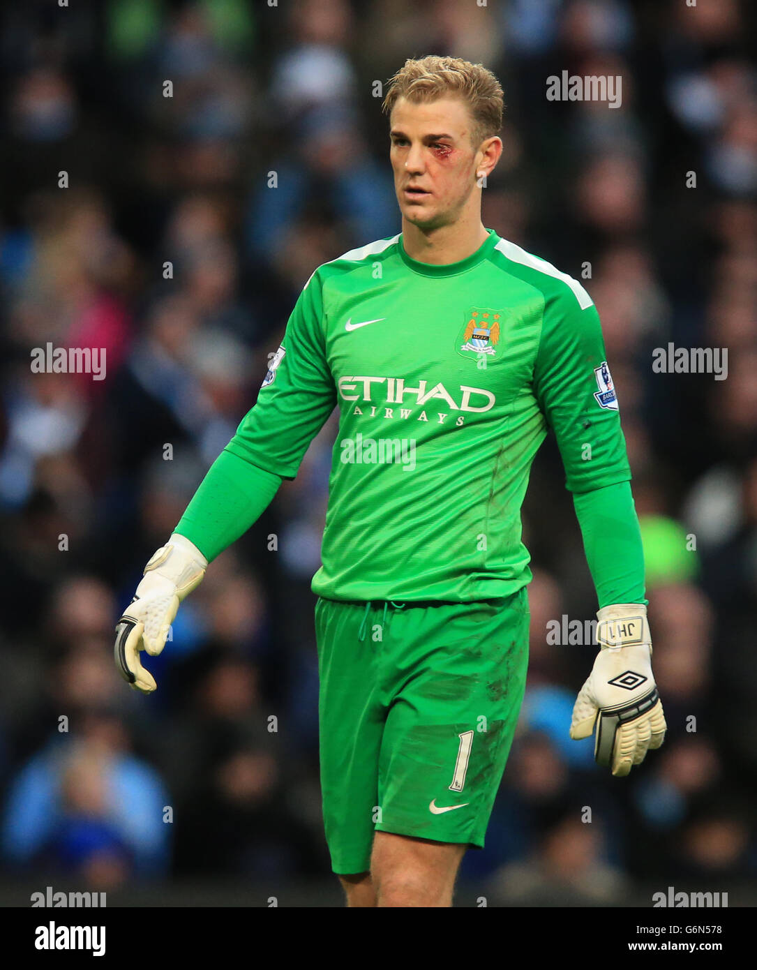 Joe Hart de Manchester City après avoir été blessé aux yeux Photo Stock -  Alamy