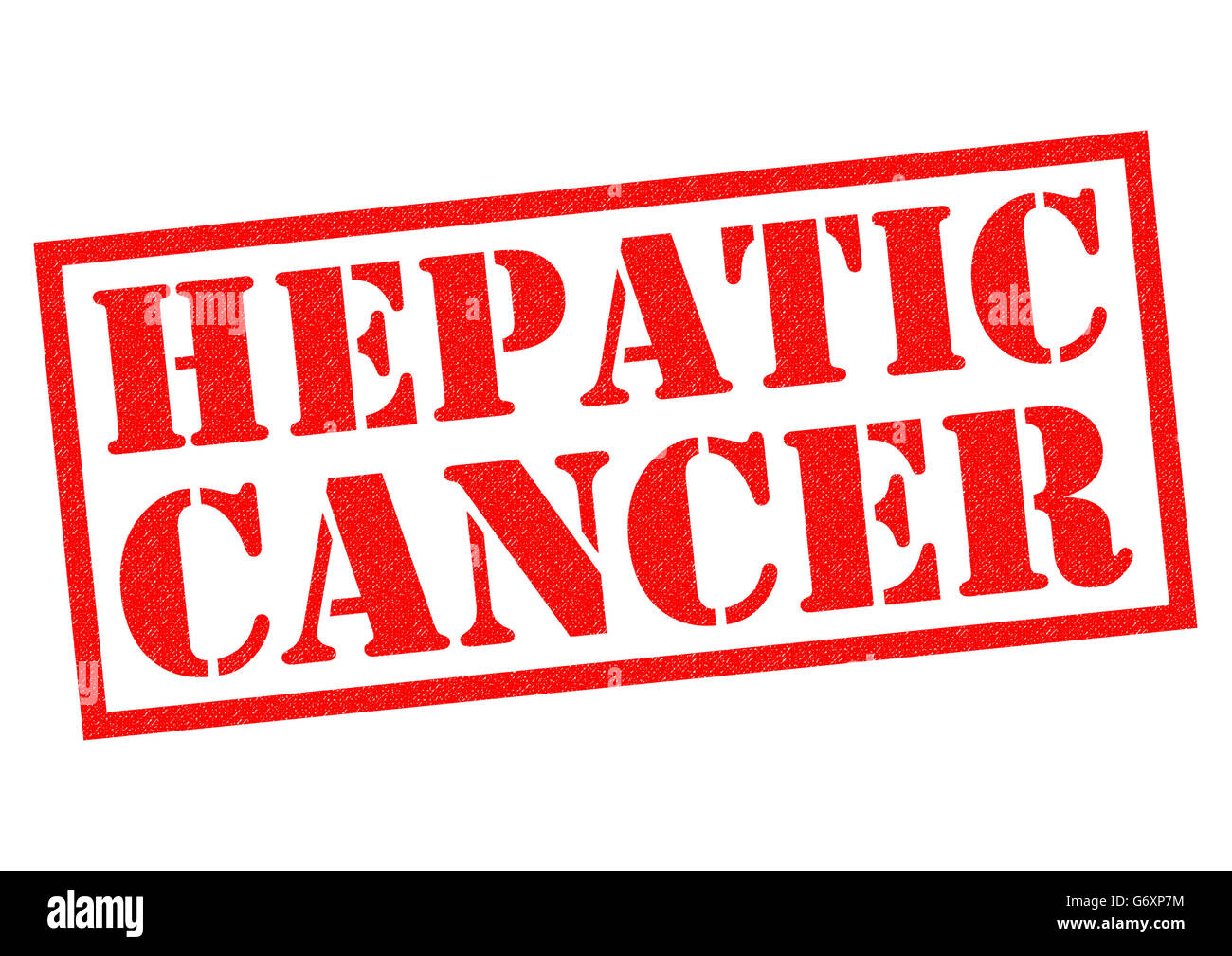 CANCER DU FOIE de tampon en caoutchouc rouge sur un fond blanc. Banque D'Images