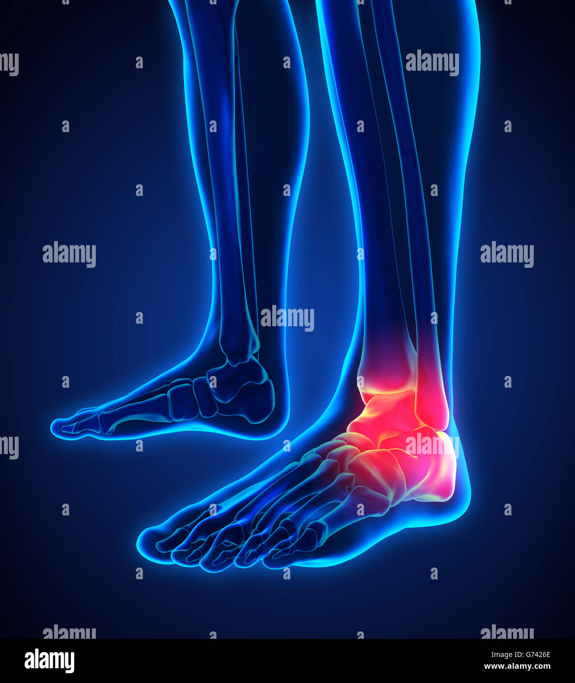 La cheville douloureuse illustration Banque D'Images