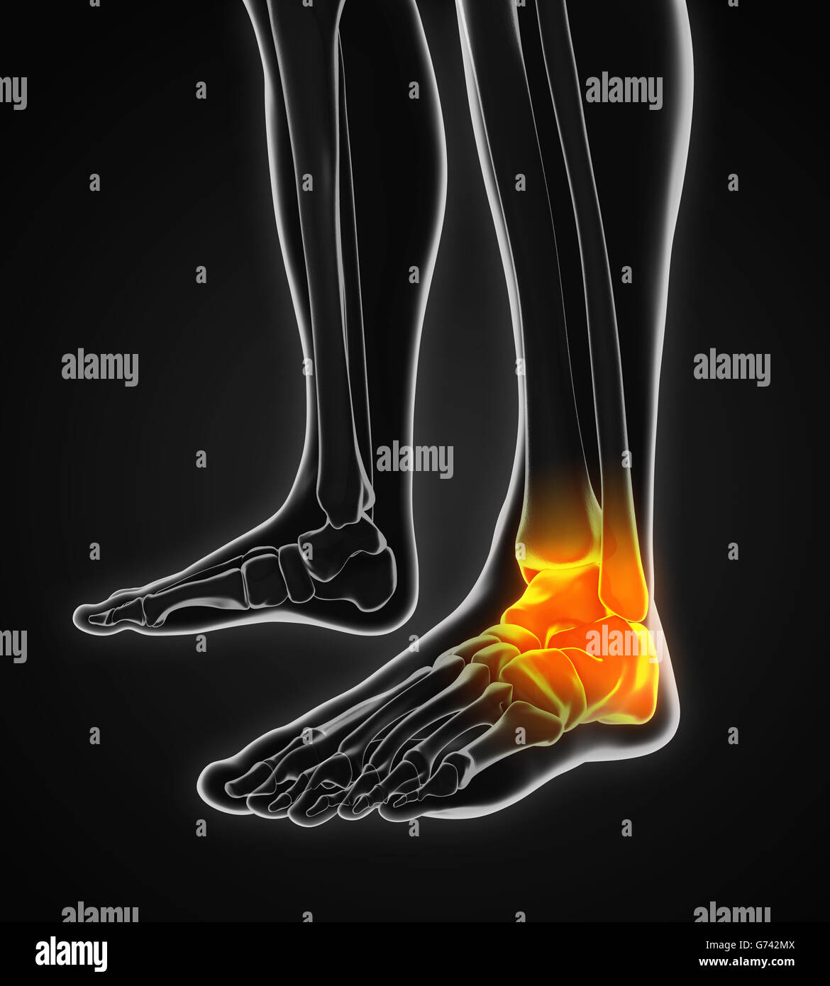 La cheville douloureuse illustration Banque D'Images