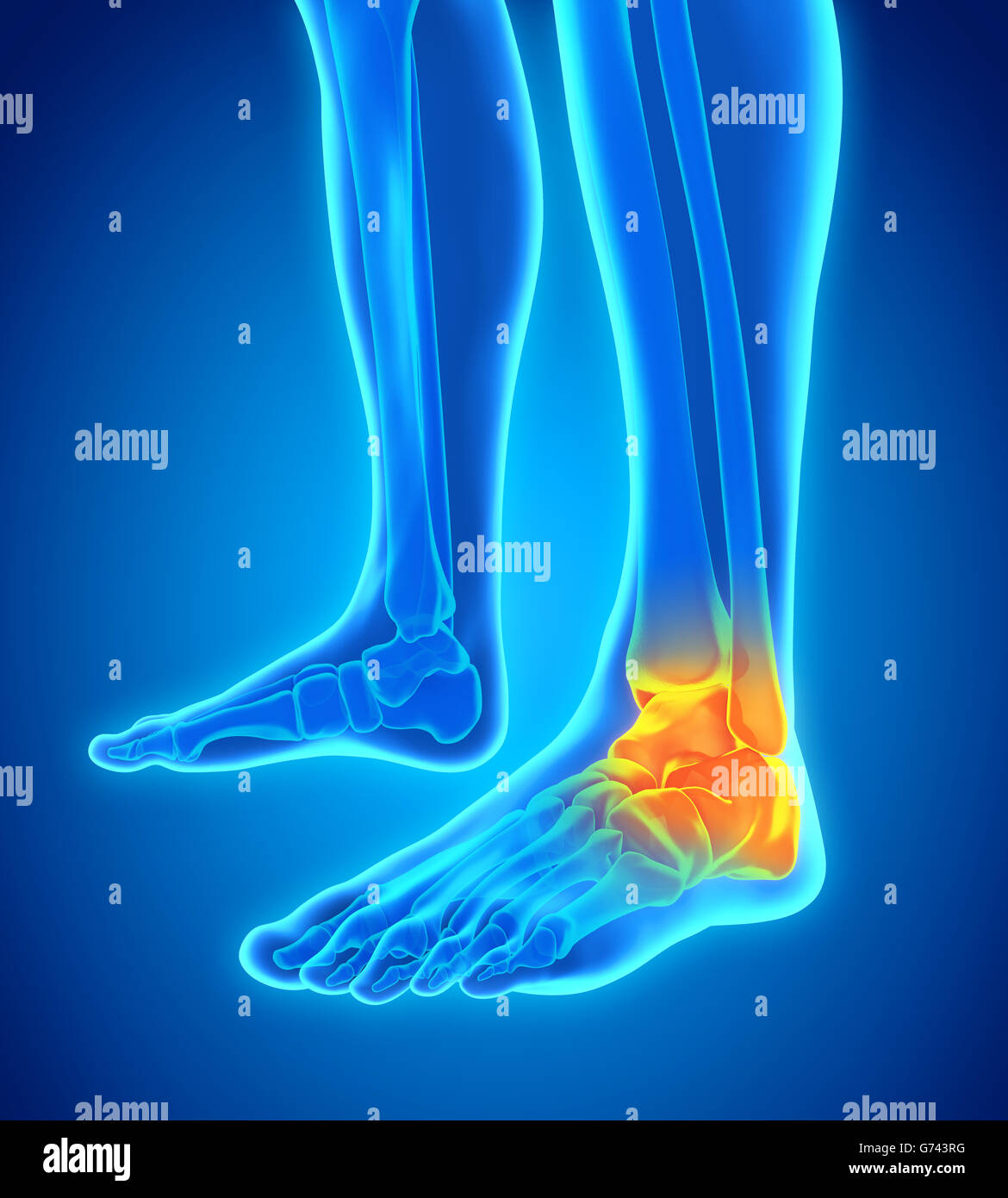 La cheville douloureuse illustration Banque D'Images
