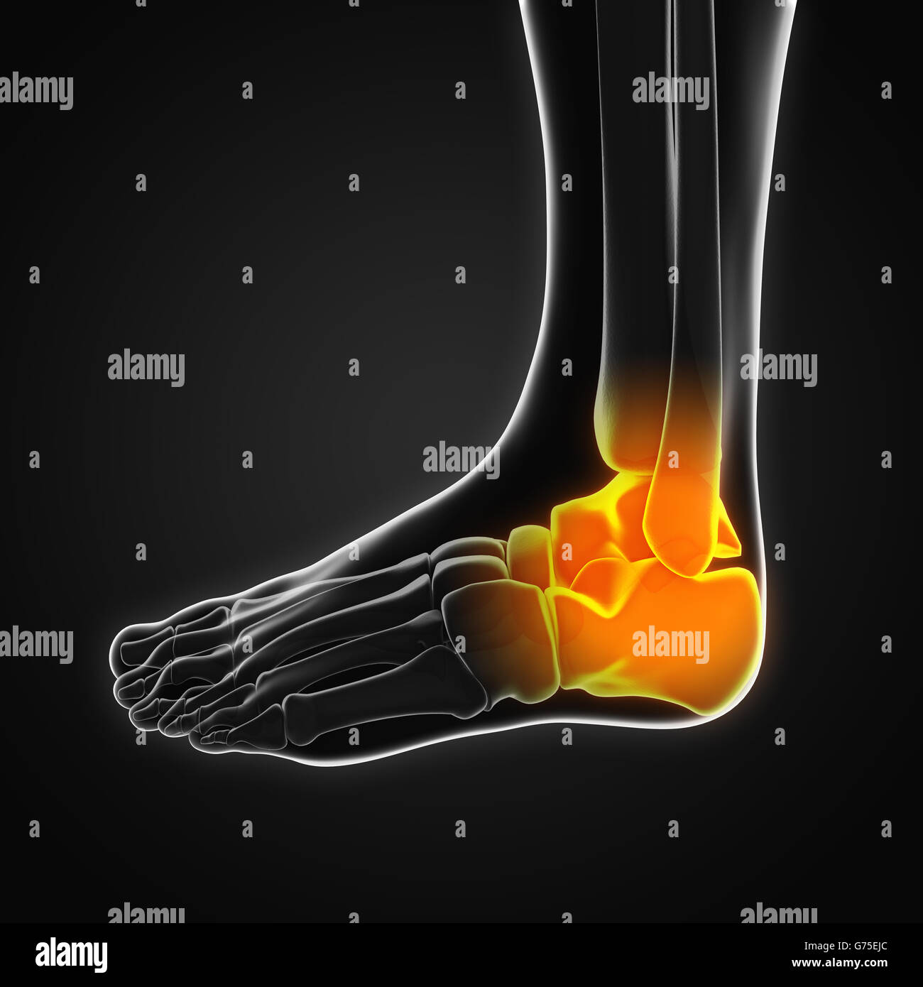 La cheville douloureuse illustration Banque D'Images