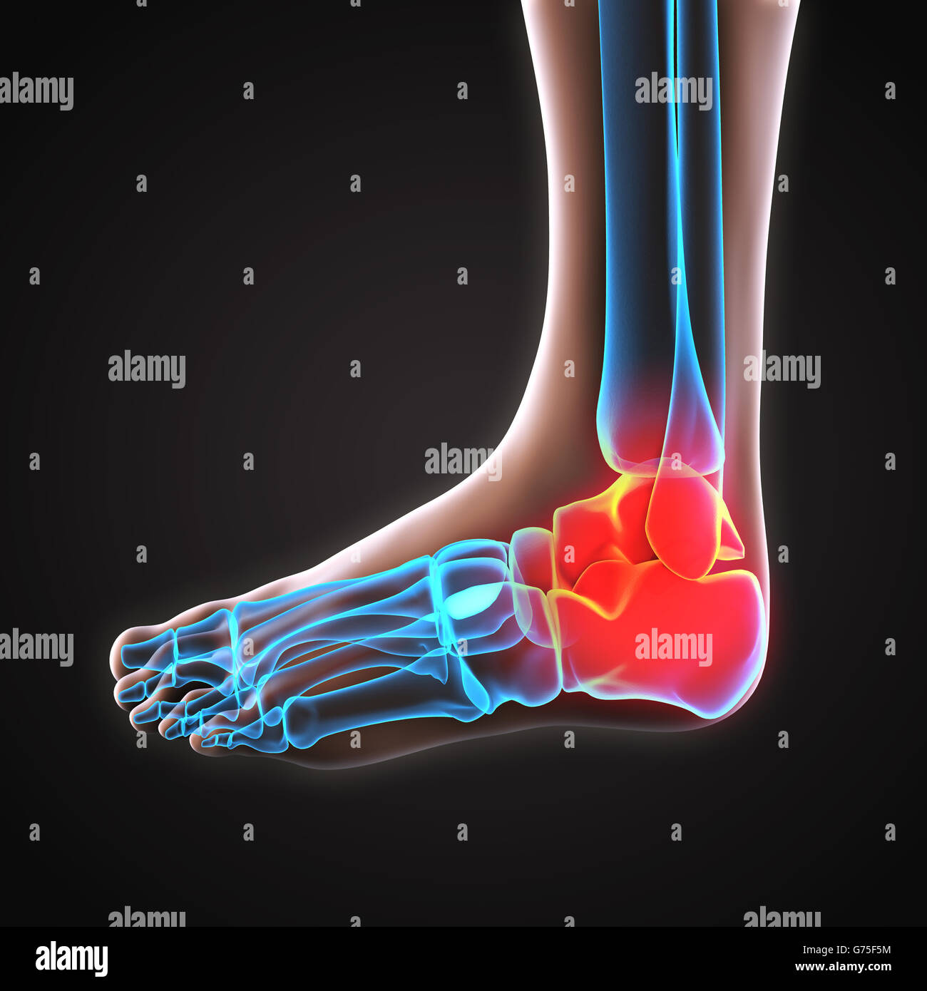 La cheville douloureuse illustration Banque D'Images