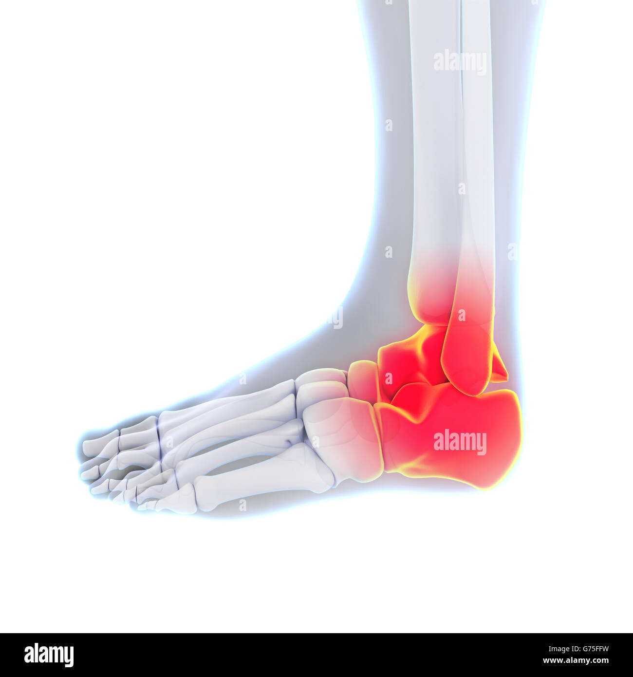 La cheville douloureuse illustration Banque D'Images