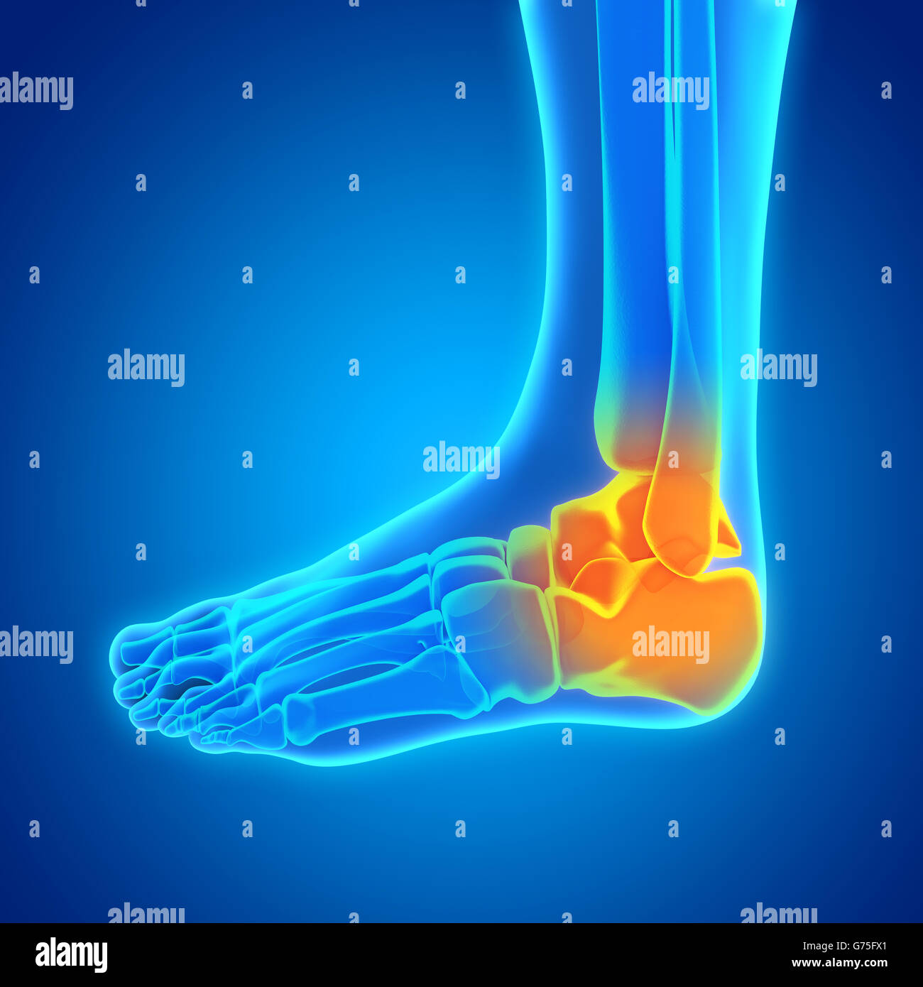 La cheville douloureuse illustration Banque D'Images