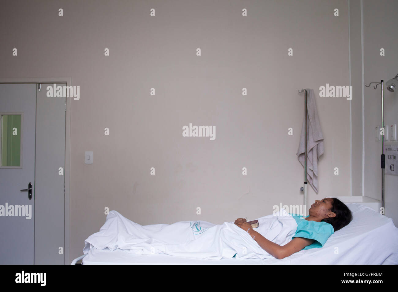 Une femme adulte admise à la Fundação de Medicina Tropical do Amazonas à Manaus, au Brésil, présente l’éruption de rougeole caractéristique – des taches maculopapulaires rouges qui commencent sur le visage et se propagent à travers le corps. Cette infection virale aéroportée hautement contagieuse souligne le besoin critique d'une couverture vaccinale solide et de mesures de santé publique renforcées dans la région amazonienne. Banque D'Images