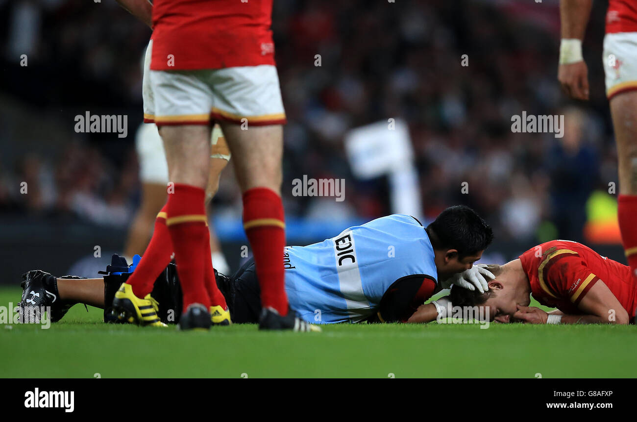 Liam Williams, pays de Galles, reçoit un traitement sur le terrain lors du match de la coupe du monde de rugby au stade de Twickenham, Londres. Banque D'Images