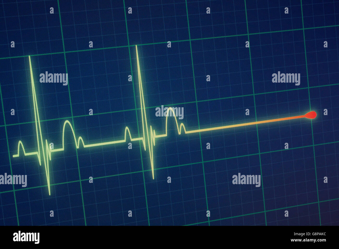 Flatline écho sur un moniteur cardiaque médical / ECG ECG (électrocardiogramme) avec fond bleu Banque D'Images
