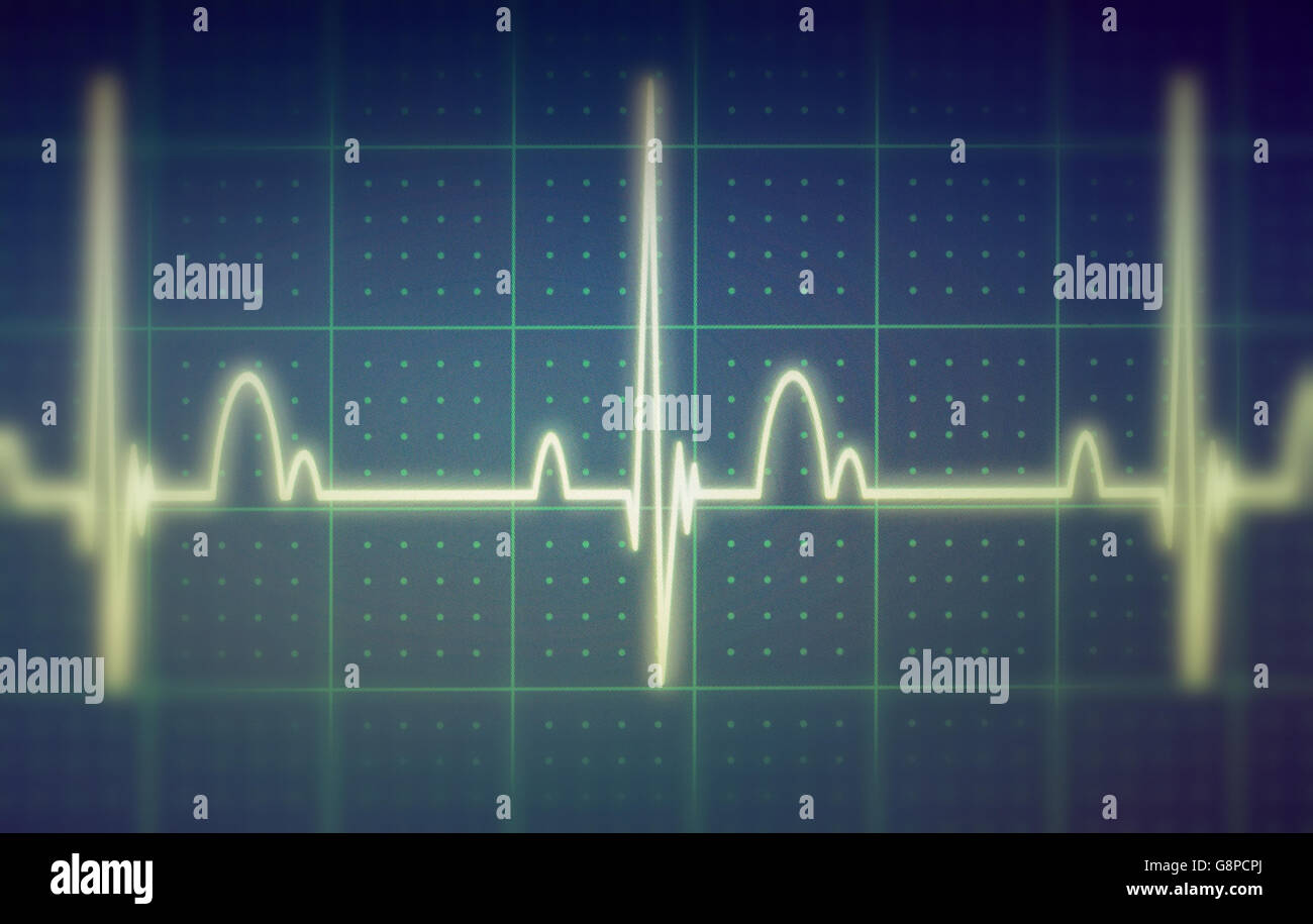 Flatline écho sur un moniteur cardiaque médical / ECG ECG (électrocardiogramme) avec fond bleu Banque D'Images