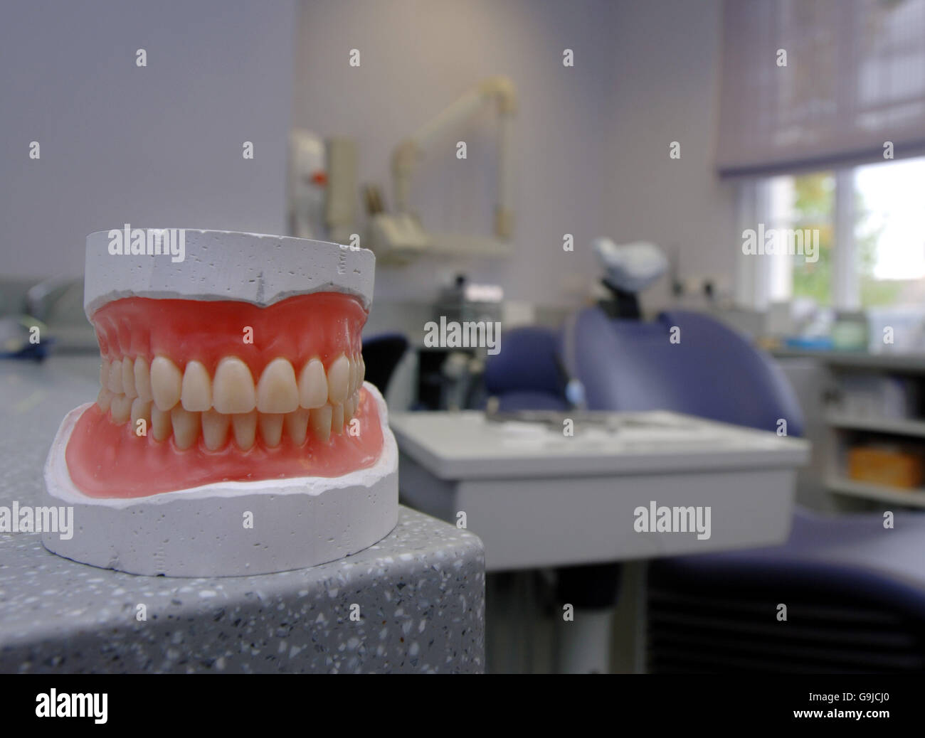 Actualités, chirurgie dentaire, fonction. Un ensemble d'impressions de prothèse Banque D'Images