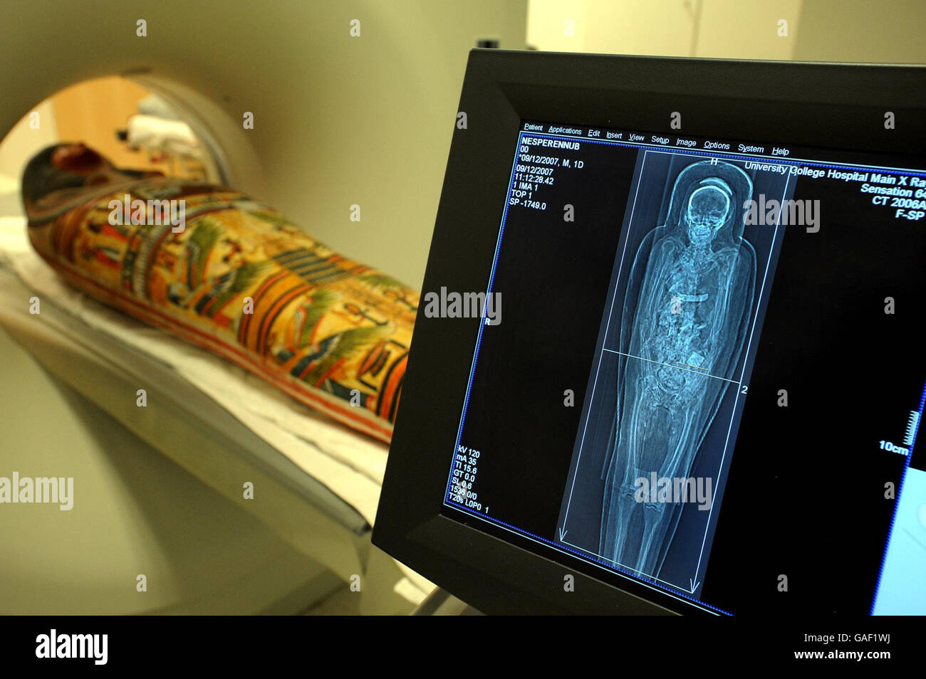 Une momie égyptienne de 3,000 ans se prépare à passer par un scanner pour  voir ce qui se trouve à l'hôpital universitaire du centre de Londres Photo  Stock - Alamy