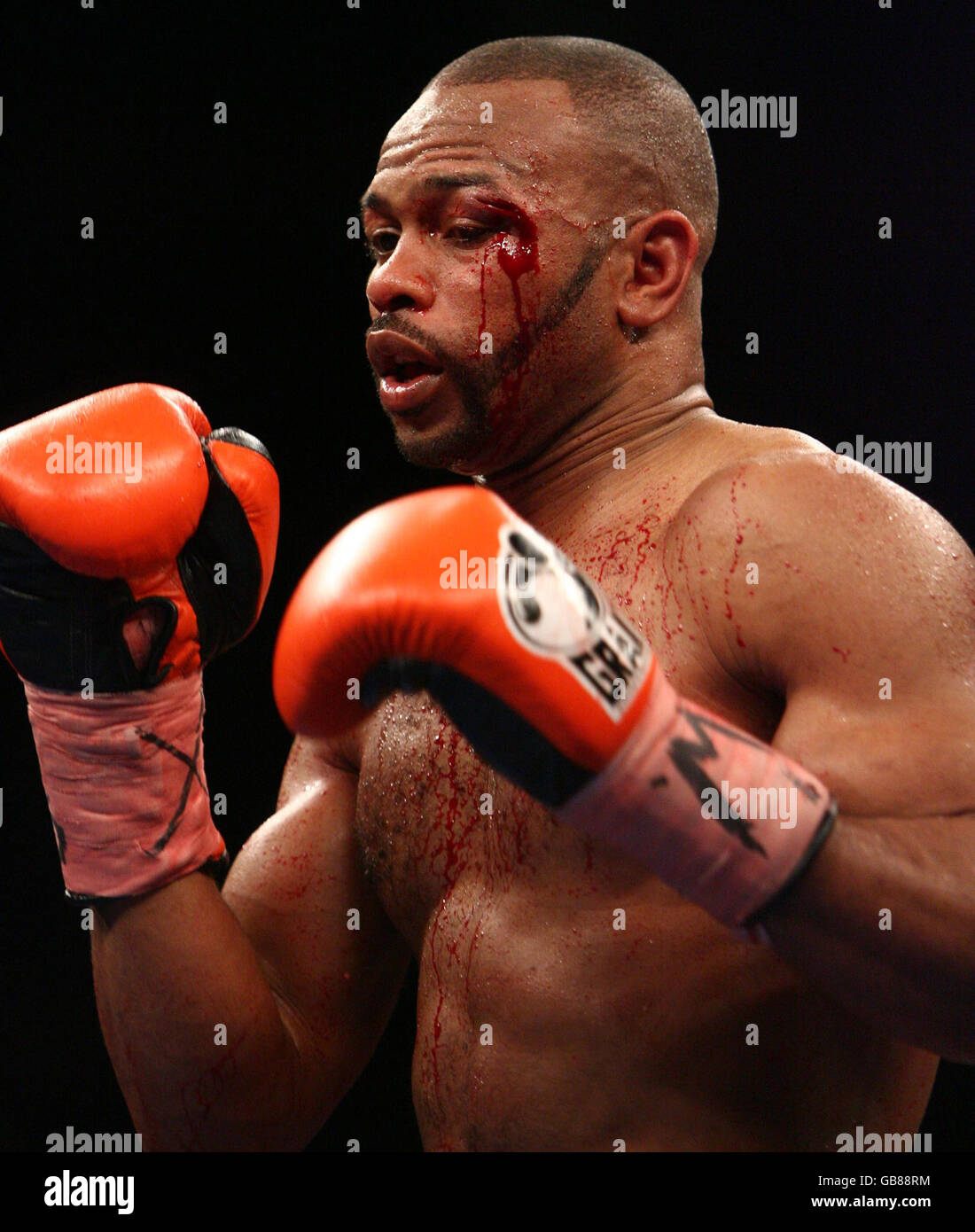 Roy Jones des États-Unis avec sa grosse coupe sur son œil gauche pendant le combat léger et lourd à Madison Square Garden, New York, États-Unis. Banque D'Images