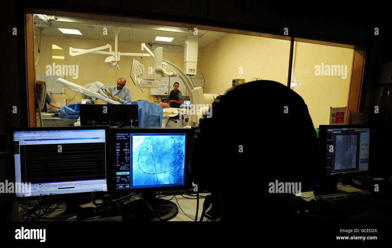 Le chirurgien Dr Andre ng, cardiologue consultant à l'hôpital de Glenfield et maître de conférences en sciences cardiovasculaires à l'université de Leicester, regarde un écran pendant qu'il guide un cathéter à l'aide d'un bras robot à l'hôpital de Glenfield à Leicester, Au cours de la première opération cardiaque à distance au monde réalisée avec le bras sur le patient Kenneth Crocker, 70, de Burton on Trent. Banque D'Images
