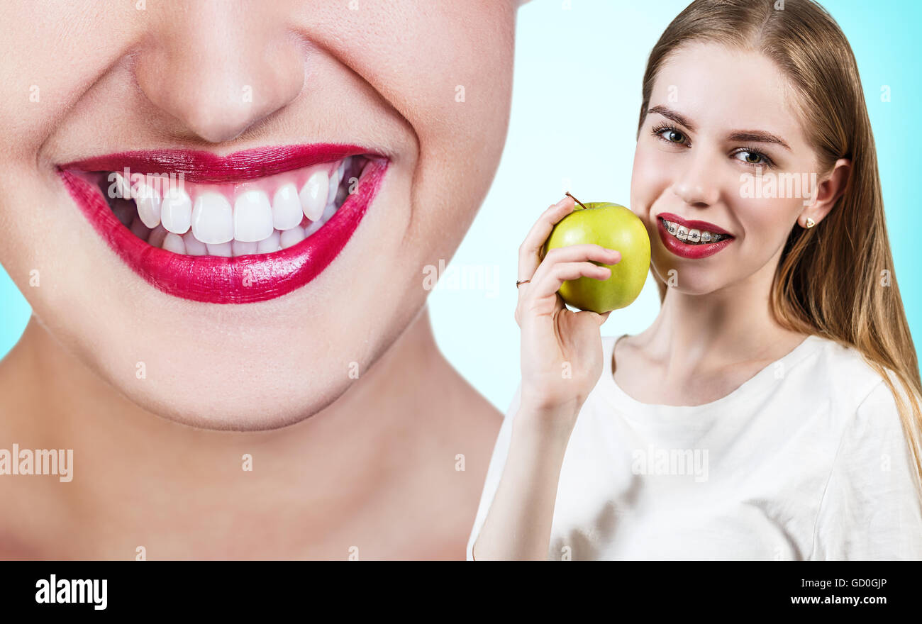 Jeune femme avec des crochets sur les dents eating apple Banque D'Images