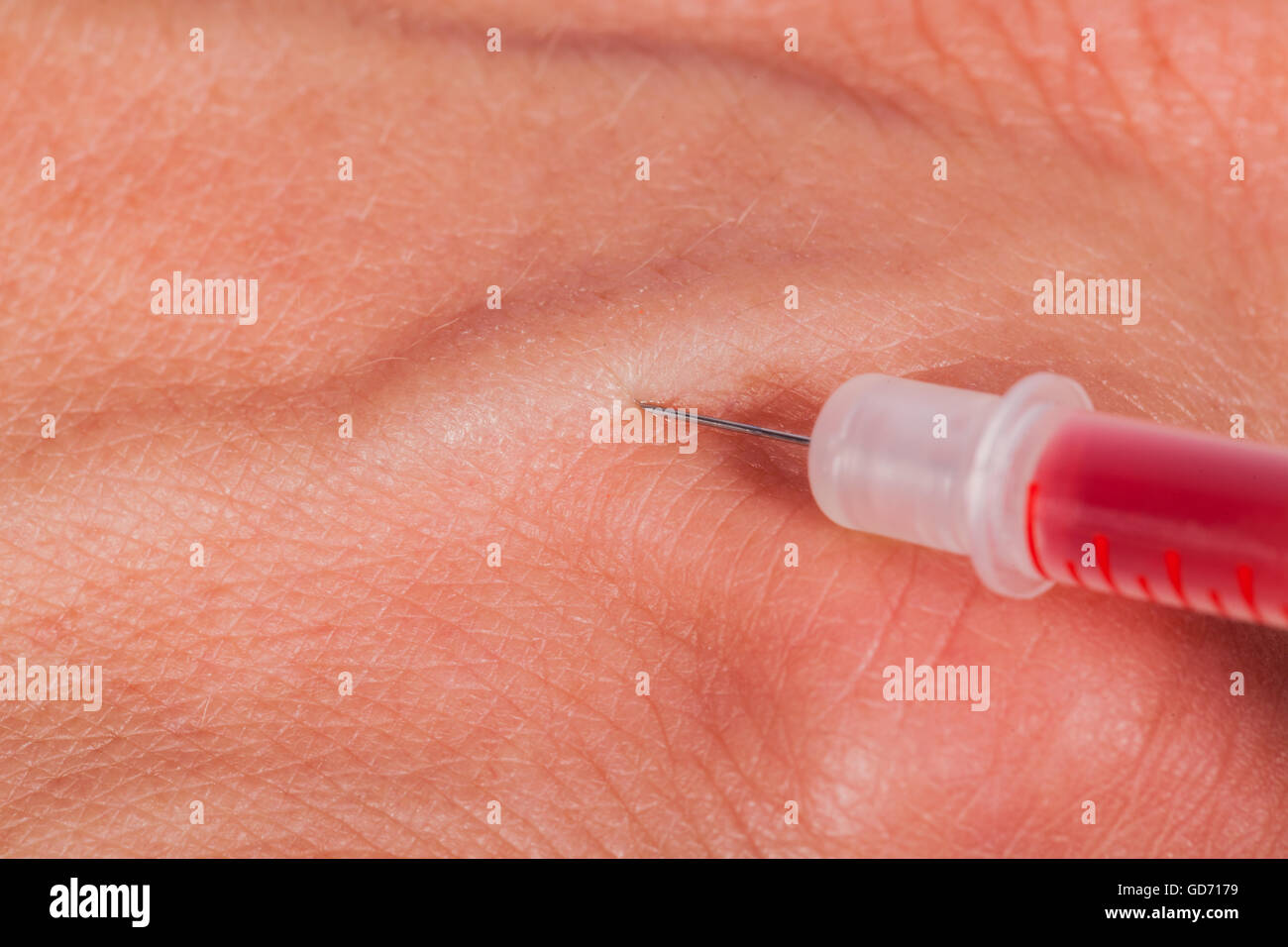 L'injection sous-cutanée medical concept avec une petite seringue  hypodermique remplie d'un liquide rouge pénétrer la peau et de la  production d'un flux de sang dégoulinant dans une vue en gros plan Photo
