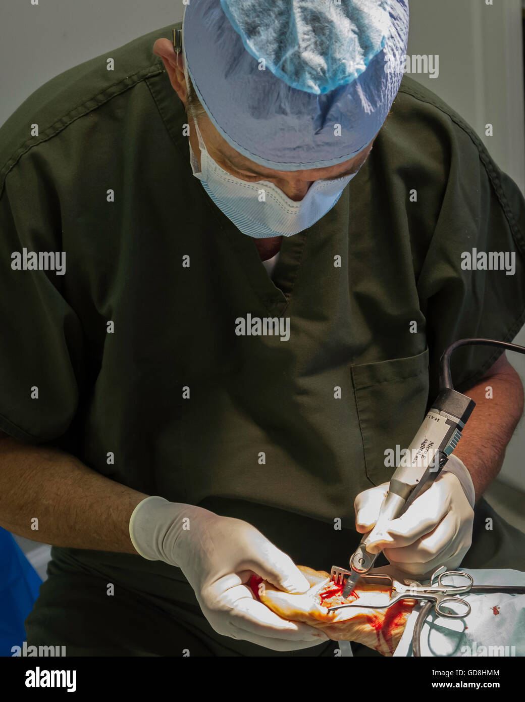 Chirurgie du pied Banque D'Images