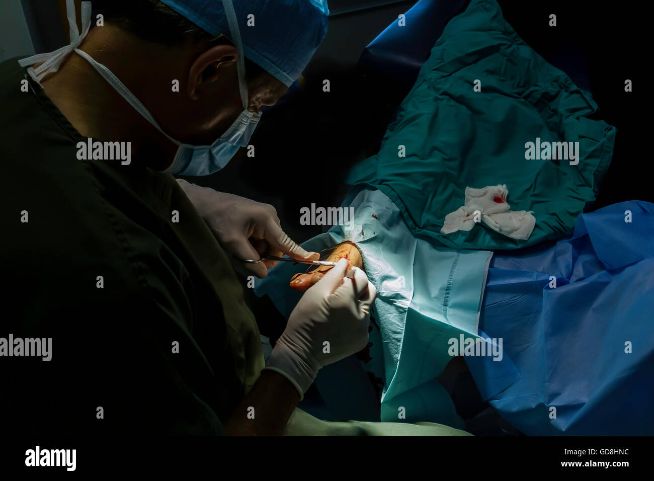 Chirurgie du pied Banque D'Images