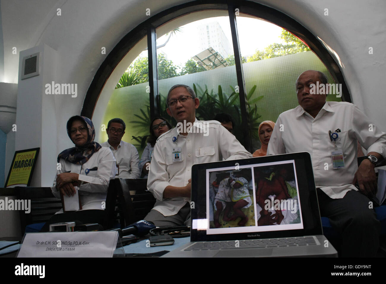 La photographie de l'omphalopagus jumeaux siamois bébé, Safira et Saqila (4 mois) a montré sur l'écran de l'ordinateur comme une équipe de médecins expliquant le plan de la séparation la chirurgie, une heure plus tôt avant de subir l'opération à Cipto Mangunkusumo Hôpital Central National. Le plan, l'opération débutera à 8h00 avec une estimation de prendre 4 heures et a réuni 40 spécialistes tels que spécialiste chirurgie pédiatrique, la chirurgie plastique, anesthésie, radiologie, réadaptation médicale, la pathologie clinique, psychiatrie, pharmaciens, et autres. Safira et Saqira sont la 23e jumeaux siamois qui feront l'objet d'une s Banque D'Images