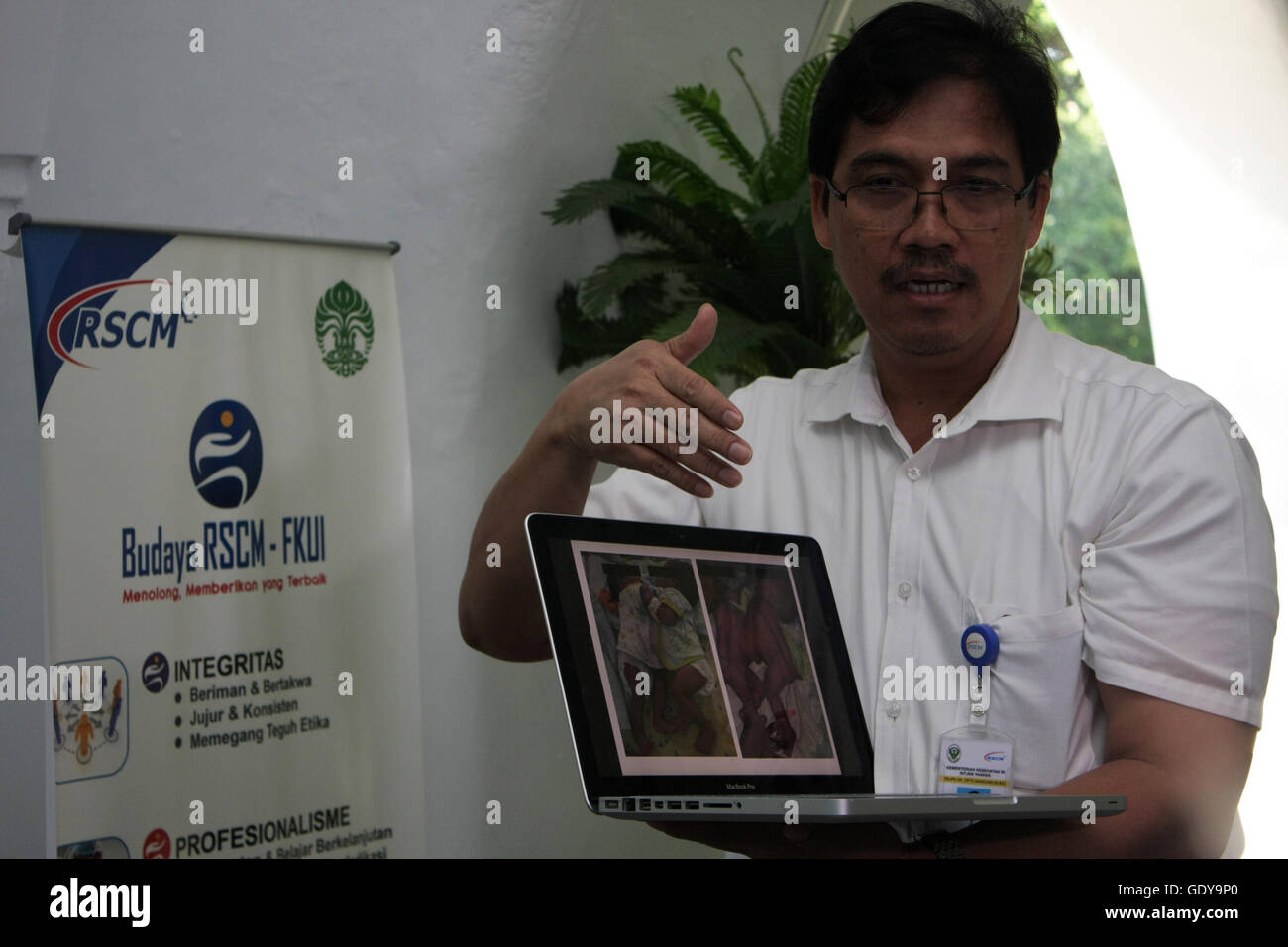 L'équipe de médecin, d'expliquer le plan de séparation des frères siamois de chirurgie (omphalopagus deux bébés fusionné à l'abdomen), bébé Safira et Saqira (4 mois) une heure plus tôt avant de subir l'opération à Cipto Mangunkusumo Hôpital Central National. Le plan, l'opération débutera à 8h00 avec une estimation de prendre 4 heures et a réuni 40 spécialistes tels que spécialiste chirurgie pédiatrique, la chirurgie plastique, anesthésie, radiologie, réadaptation médicale, la pathologie clinique, psychiatrie, pharmaciens, et autres. Safira et Saqira sont la 23e jumeaux siamois qui feront l'objet d'une opération de séparation par Banque D'Images