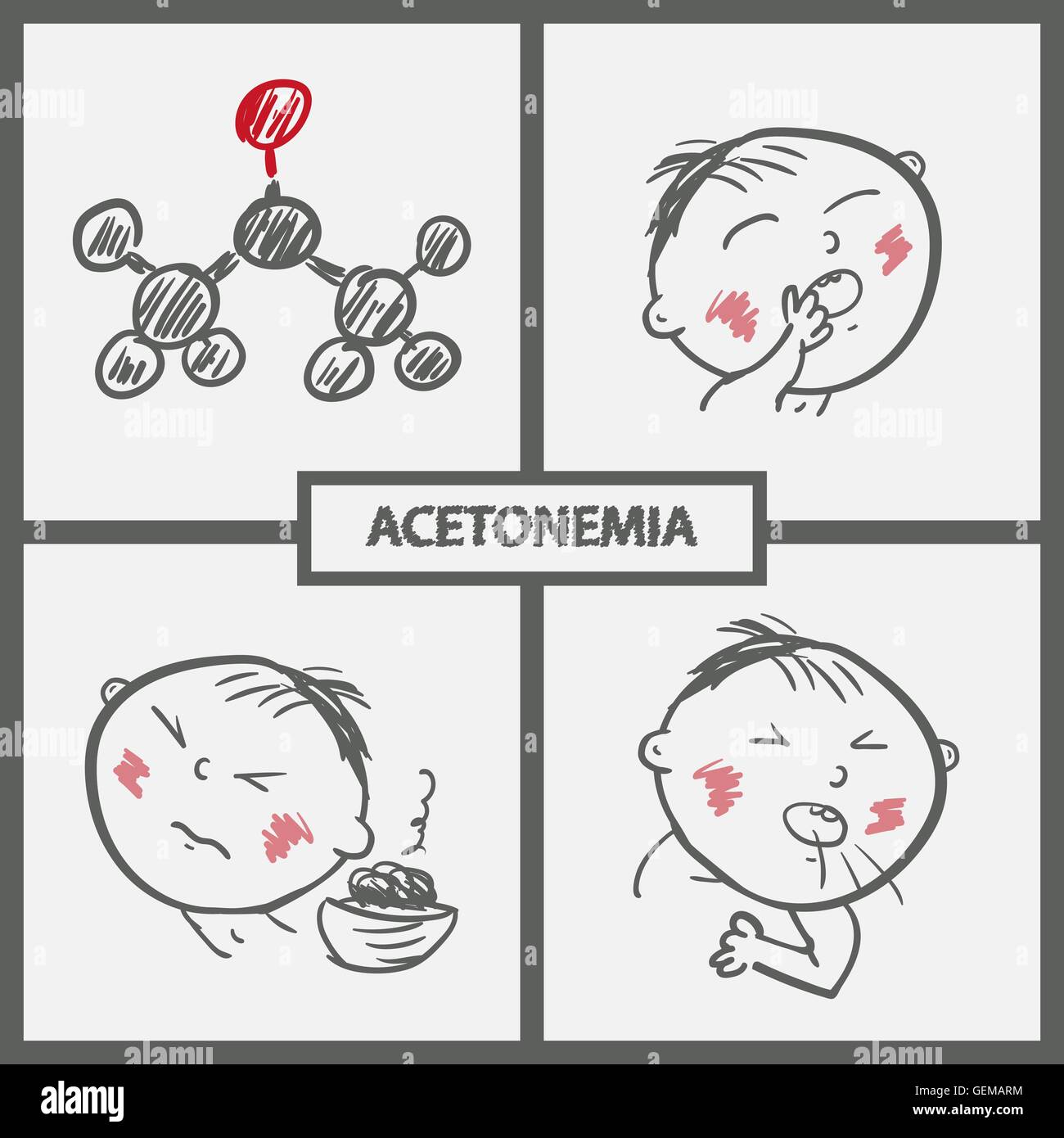 Les symptômes de l'enfant avec acetonemia et la molécule d'acétone. Hand drawn vector icons. Illustration de Vecteur