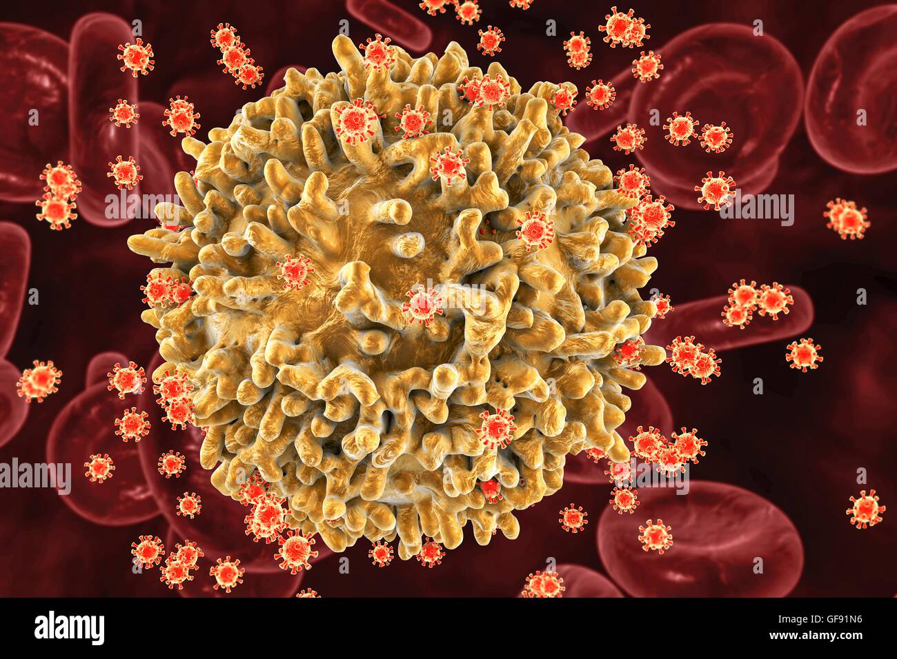 Le VIH virus infectant les lymphocytes T, illustration de l'ordinateur. La surface de la T-cell a une apparence grumeleuse avec de grandes protubérances de surface irrégulière. Les petites structures sphériques sur la surface des particules virales du VIH sont loin de la cellule en herbe memb Banque D'Images