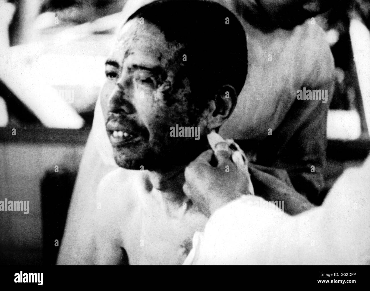 Hiroshima : victime de la bombe atomique au Japon du 20ème siècle - la seconde guerre mondiale, archives nationales. Washington Banque D'Images