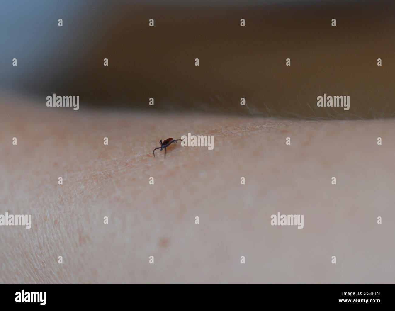 Tick seraching pour place de mordre sur les droits de l'arm Banque D'Images