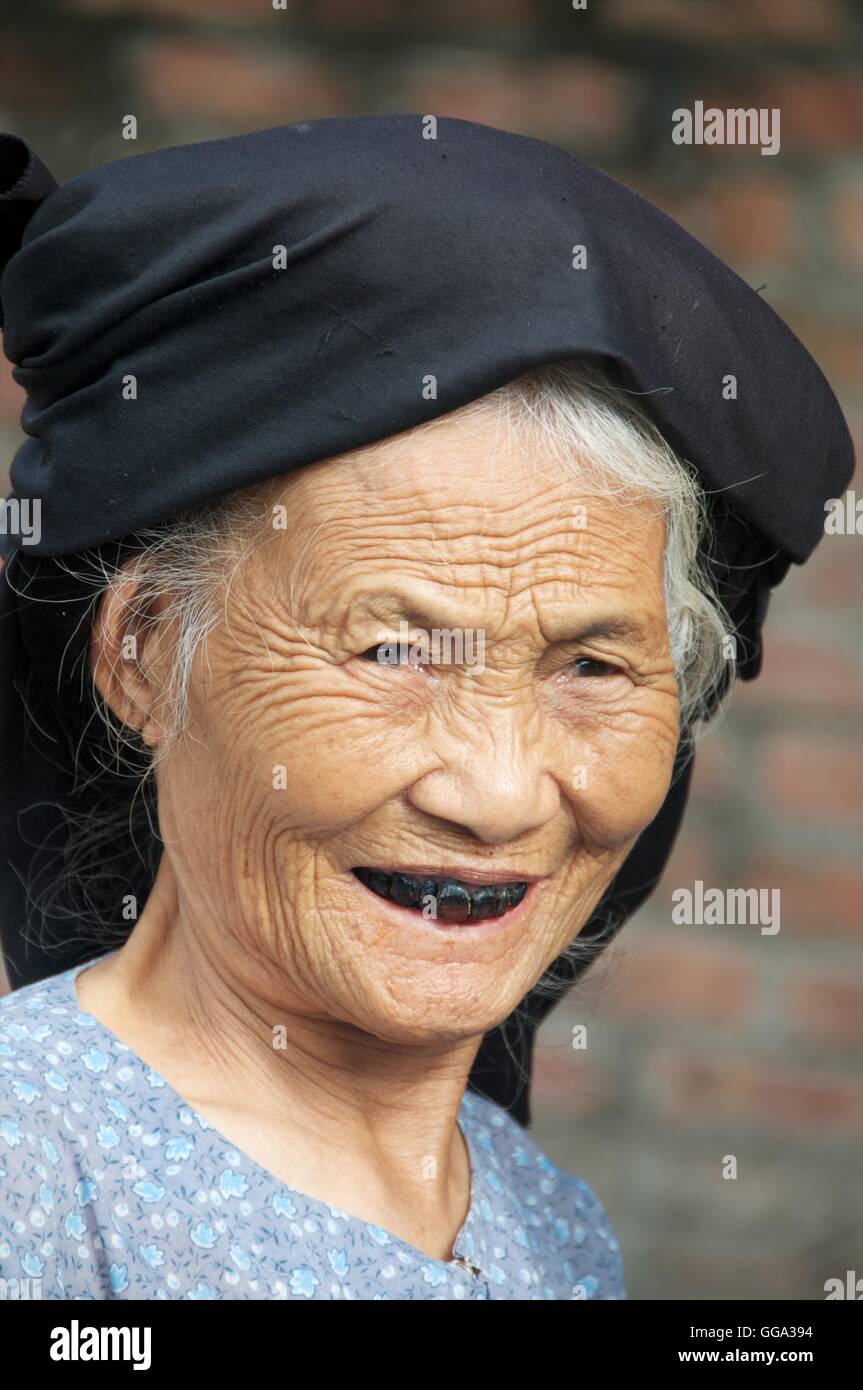 Delta du Fleuve Rouge, au Vietnam - 12 novembre 2015. Femme âgée avec les dents tachées de bétel. Banque D'Images