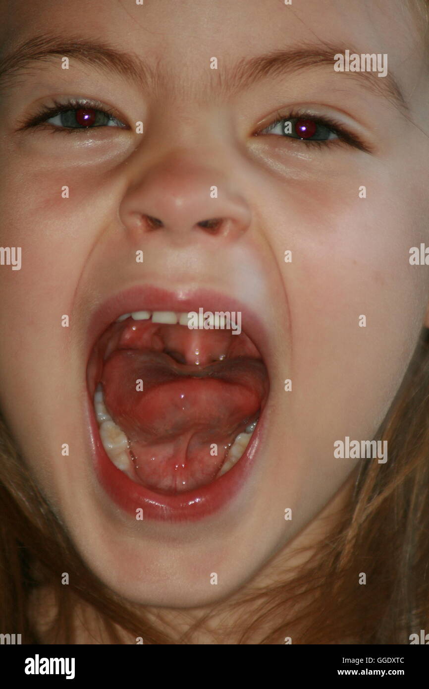Enfant avec bouche ouverte Photo Stock Alamy
